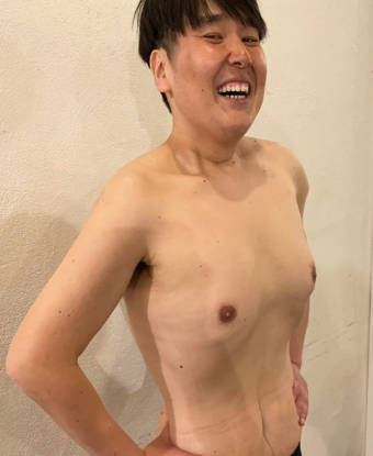 ガリガリガリクソンが激やせ3
